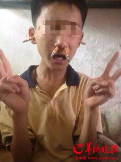 图为：智力障碍男生小亮遭同宿舍的六名男生用烟头插在鼻孔和耳孔。